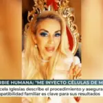 Marcela Iglesias, la 'Barbie humana' que se inyecta sangre de su hijo para lograr una apariencia 'eternamente' joven